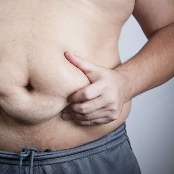 Liposuction for Men Houston TX  Male Liposuction – Houston Lipo Center